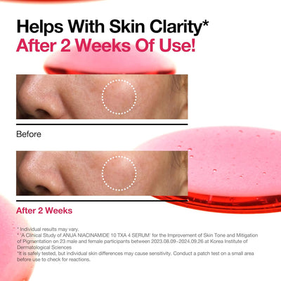 Anua 10% Niacinamide+ 4% Tranexamic Acid Serum, Ceramide, Hyaluronic Acid, Vitamin B12 natural color, for Sensitive skin, Korean Glass Skin, Fragrance-Free (30ml /1.01 fl.oz.)